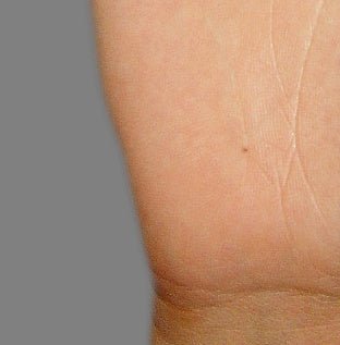 Asta Svirkienė. Apgamų reikšmė delnuose - DU PASAULIAI